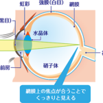 コンタクトレンズについて